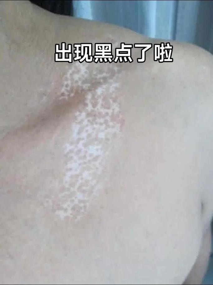 ����װ�ë���е��