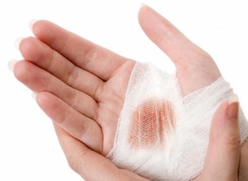 重庆哪家医院专治白癜风 白癜风多长时间扩散 重庆哪家医院专治白癜风 白癜风多长时间扩散