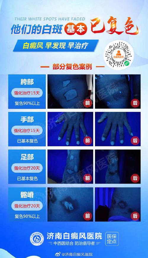 ������̰��������