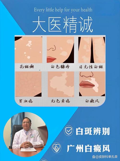 白癜风难治么 白癜风难治愈 白癜风难治么 白癜风难治愈