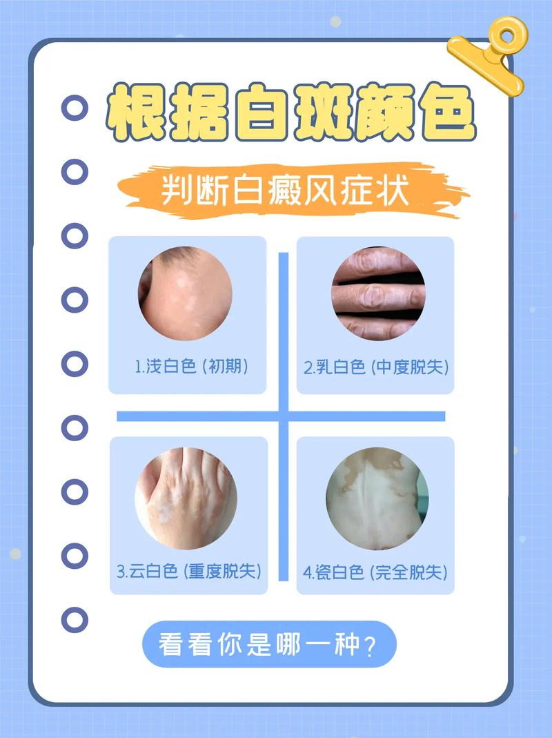 �����ĸ����ư����ҽԺ�� ʲô�Ǿ����԰���