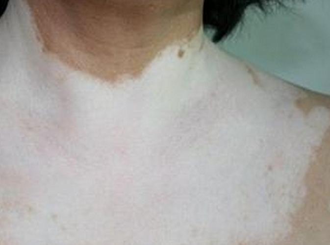 ͯҥ��ȫ100���ʶ�