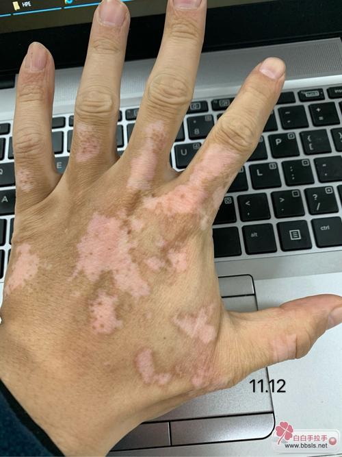 Ԥ����������Ч����