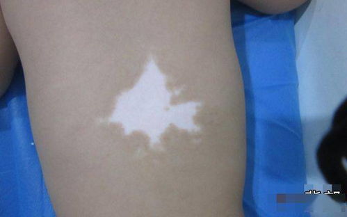 ����ר�ΰ���ҽԺ С��������������