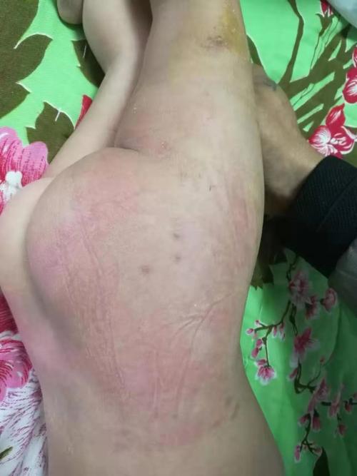 �ɶ����ư���ҽԺ�����Ȱ���¿���ֻ��ҩ���κð�����