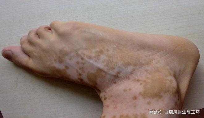 邓超的作品邓超作品里的龅牙妹 邓超的作品邓超作品里的龅牙妹