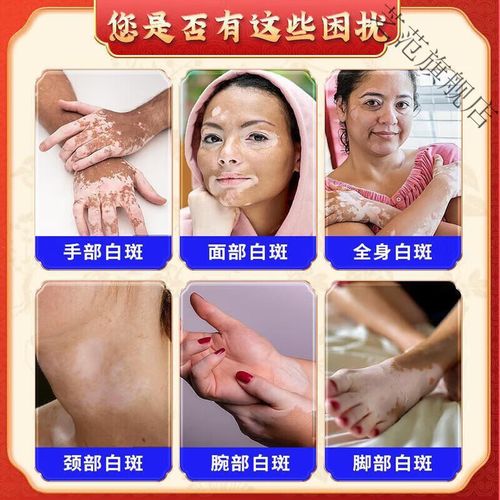 ���ݶ�ͯ����ֲƤ����