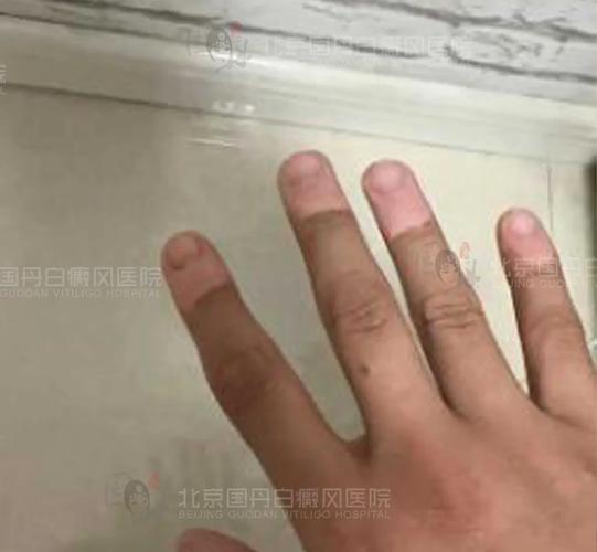 �������ư���Ҫ����Ǯ