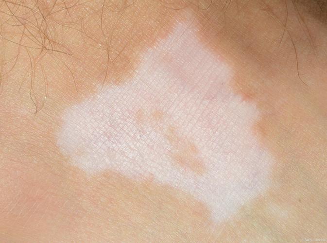 ������ר�ΰ���ĺ�ҽԺ ����ҽ���ư�������Щ����