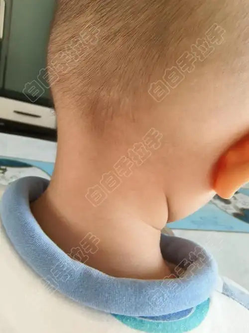 ����ܹ� ���紦��ʹ