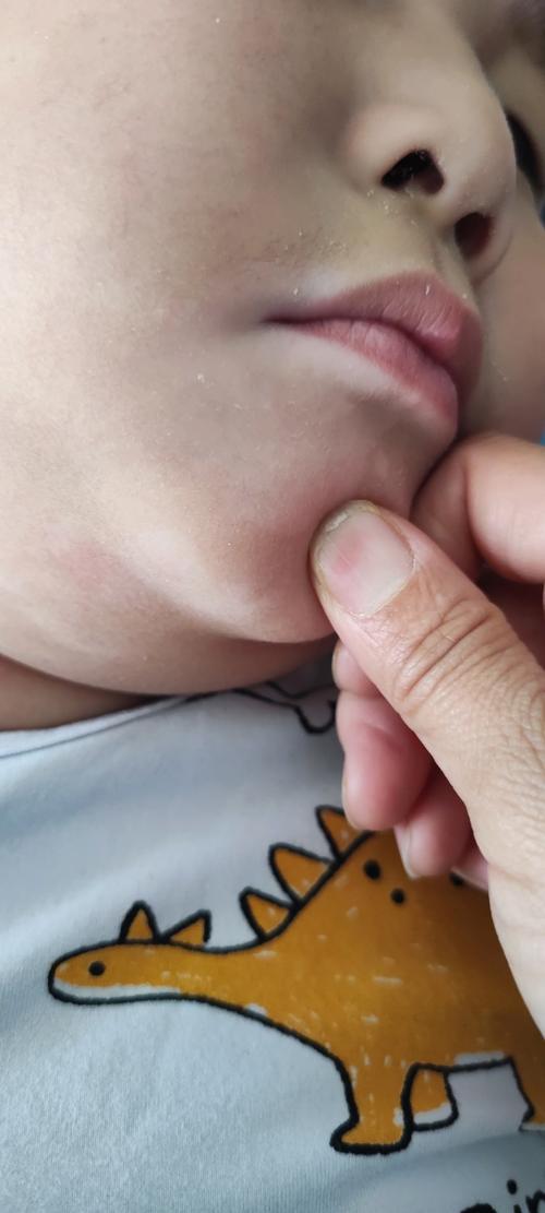 ��ҽ��������ư���� �人�ĸ�ҽԺ�����εú�