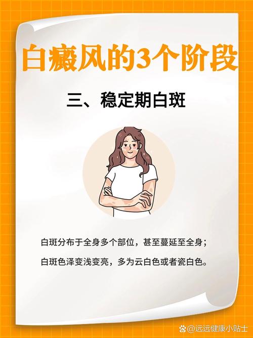 兰州白癜风医院排名大全 脸上的白癜风如何医治 兰州白癜风医院排名大全 脸上的白癜风如何医治