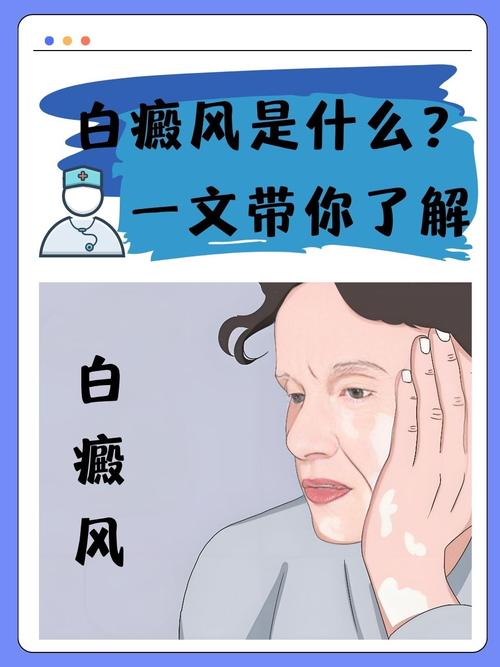 �ճ˱��� �ճ˱������ҽ�����ôд