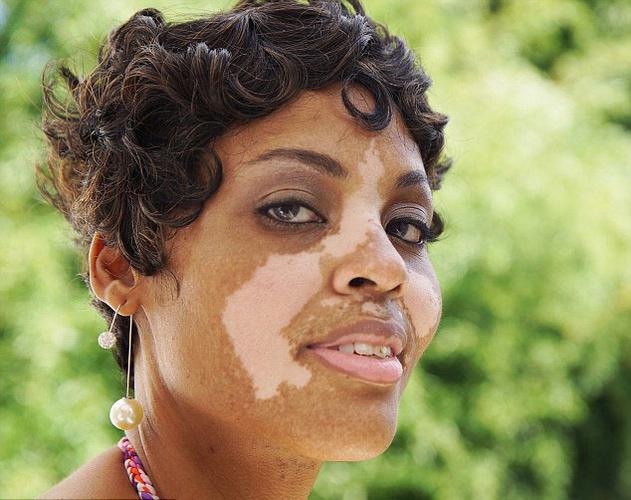 ������ʲô���µ� ����ĸ�ҽԺ���ΰ���