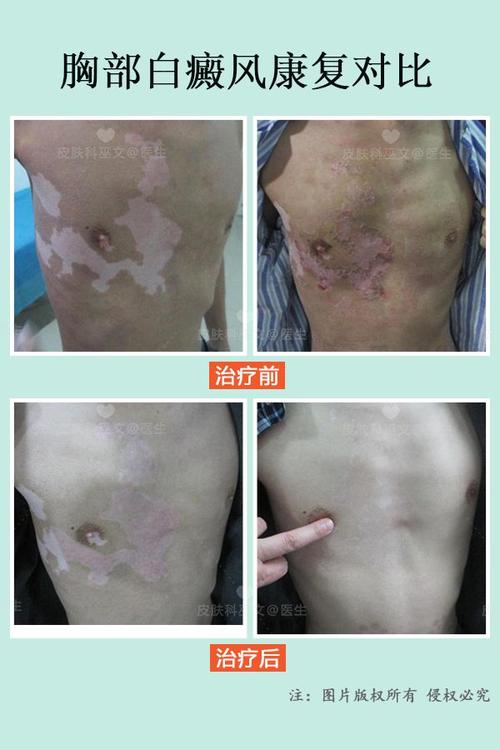 ɢ������ ɢ�����ʻ����ܲ�����Ч����