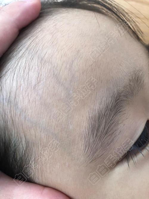 �����ΰ����ĸ�ҽԺ�� �����ʲôʳ���