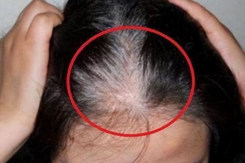 沈阳治白癜风奇人(沈阳治白癜风排行) 沈阳治白癜风奇人(沈阳治白癜风排行)