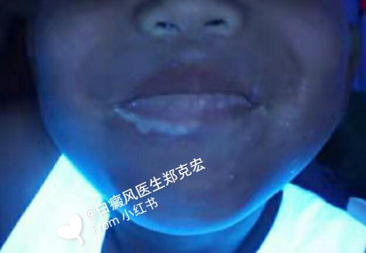 ����������ɱ����Ů��