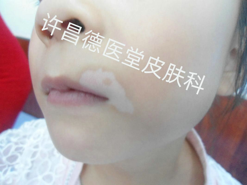 �����ļ�ҽԺʵ��ǿ