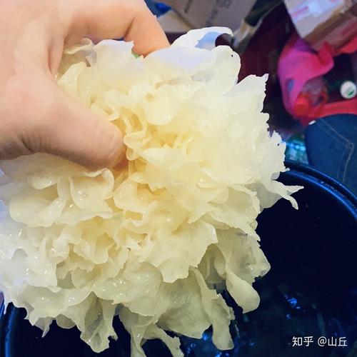 白癜风饮食禁忌女孩解说 白癜风饮食禁忌女孩解说