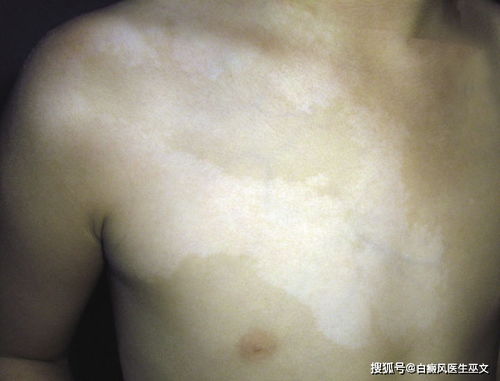 �Ϻ��ΰ��������ҽԺ �����԰����Ŵ���