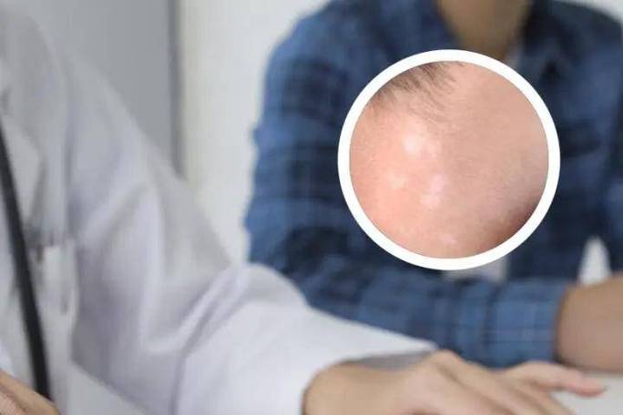 ʲôԭ���°��� ï�������ƺð����ҽԺ