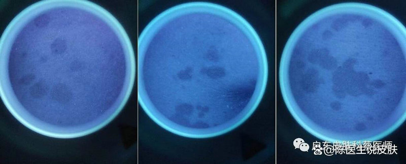 �����������ö೤����