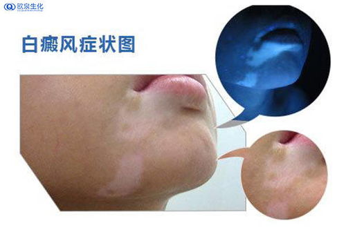 ������ôȥҽԺȷ��