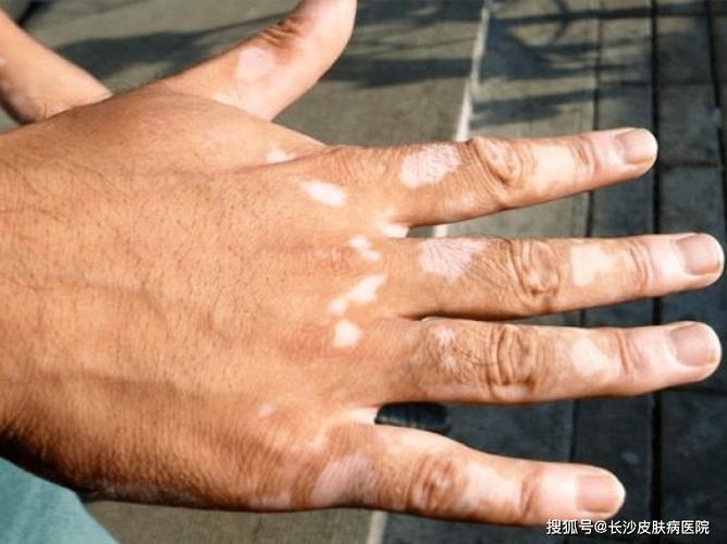 ��Ұ����ҩ���ư���