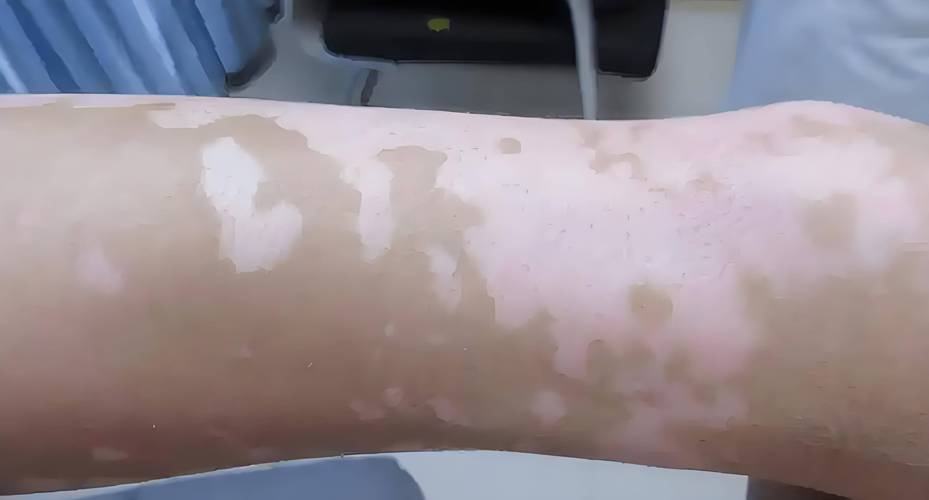 С��������֢״ С���������ԭ��