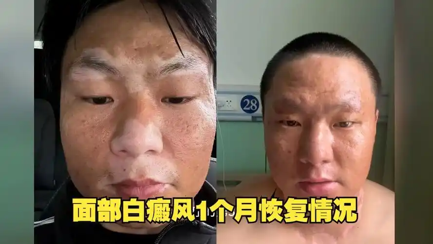 �װ߶��ǰ����� �װ�һ���ǰ����