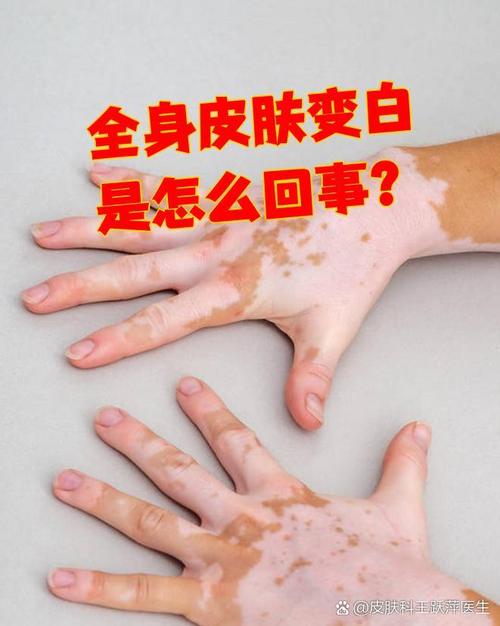 �人���� �人�������ӳ��߽�չ