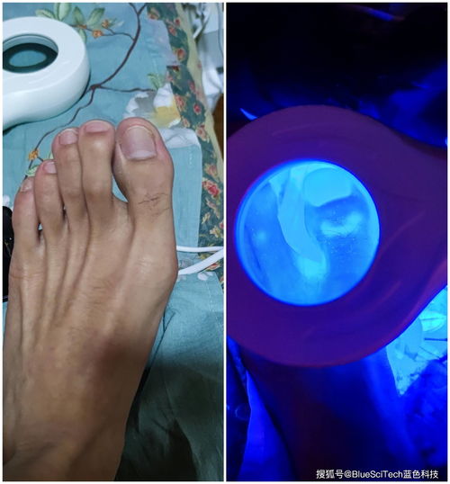 �����ճ�����(���粡�˵��ճ�����)