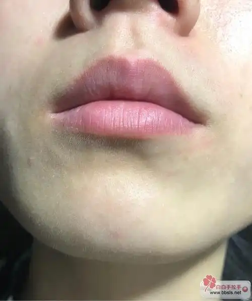 ��������֢״������