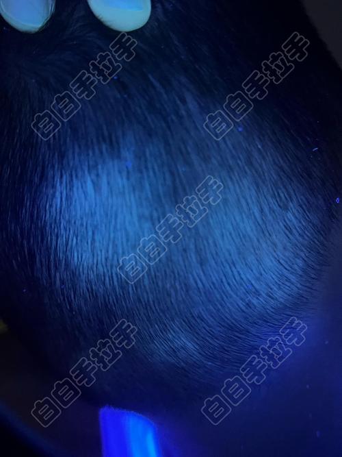 激素治疗白癜风有什么副作用 广州好的治疗白癜风的医院 激素治疗白癜风有什么副作用 广州好的治疗白癜风的医院