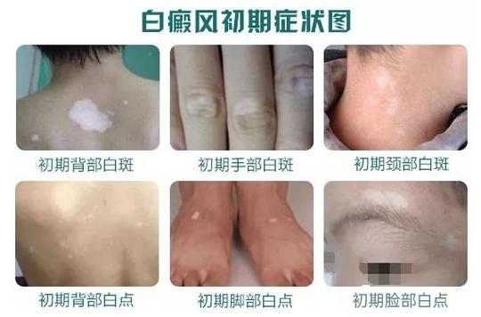 �ɶ��ļҰ���ҽԺרҵ��ɰ�����β���Ӧ��ע��ʲô