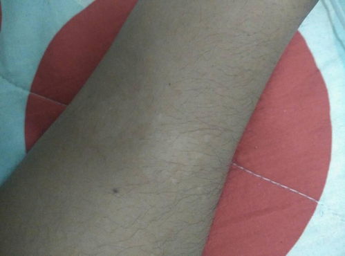 ���ʰ����Ŀ��ú� �������ư�����õ�ҽԺ