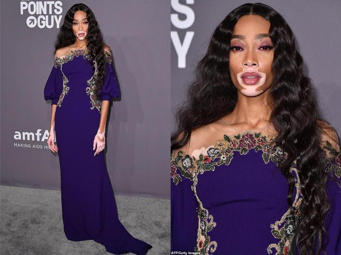 白癜风医院医护 白癜风医疗 白癜风医院医护 白癜风医疗