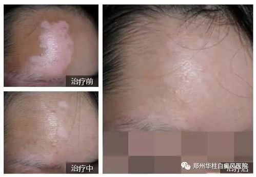 ���ϵİ�����θ���