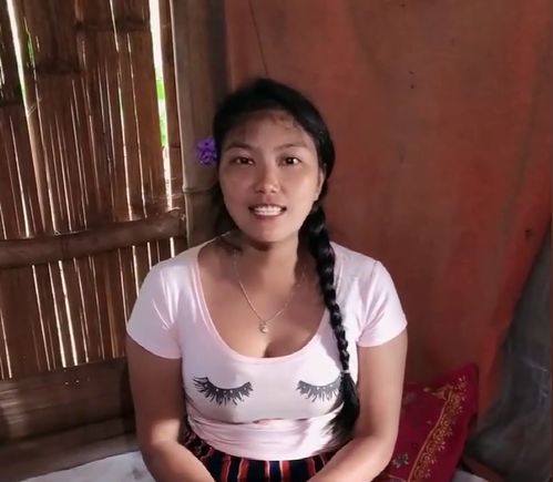 化妆品对白癜风的治疗有影响吗 揭阳治疗白癜风的专业医院 化妆品对白癜风的治疗有影响吗 揭阳治疗白癜风的专业医院