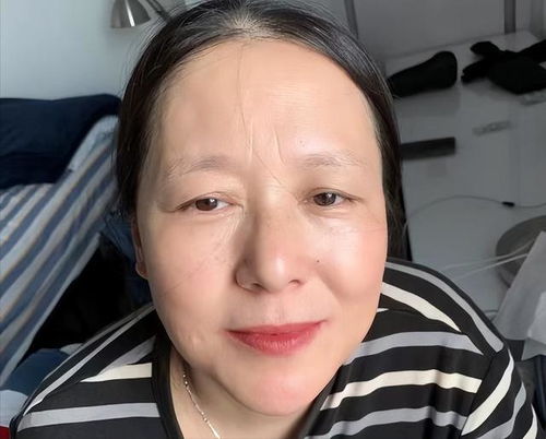 白癜风治愈还能复发吗 白癜风治愈还能复发吗