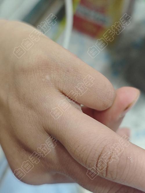 �人ר�ΰ��������ҽԺ �����ɫ����ֲ�����������