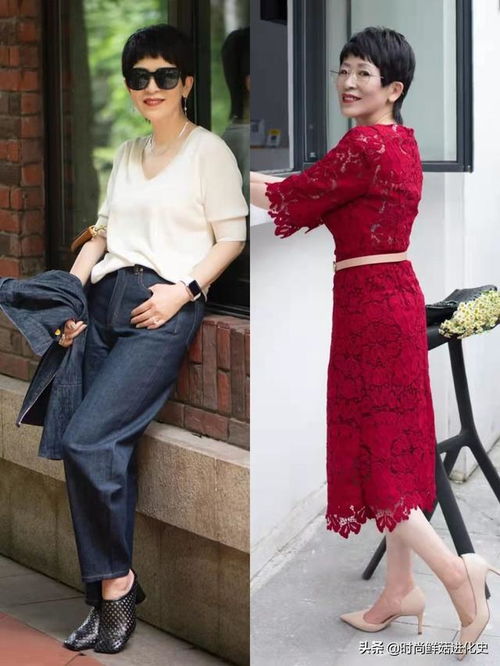 长春白癜风去哪家医院 长春白癜风去哪家医院