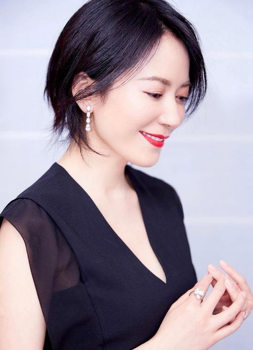 兰州治疗白癜风去哪家医院好 白癜风注意事项有哪些 兰州治疗白癜风去哪家医院好 白癜风注意事项有哪些