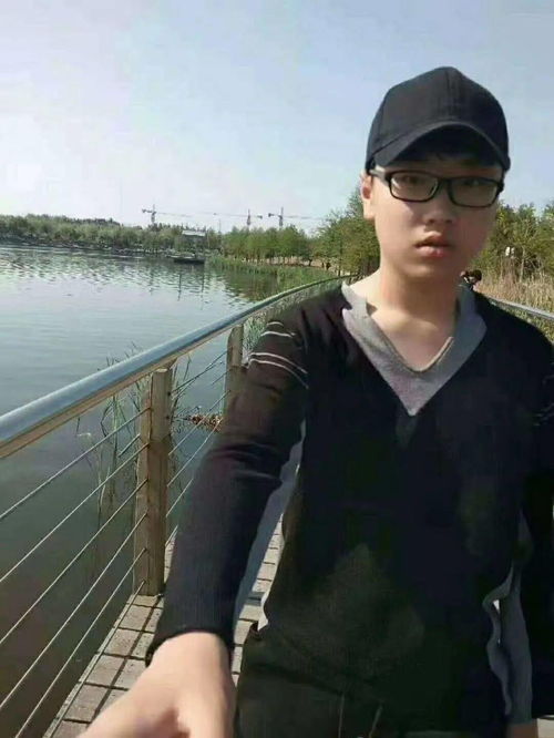 白癜风怎么浑身痒 白癜风浑身痒吗 白癜风怎么浑身痒 白癜风浑身痒吗