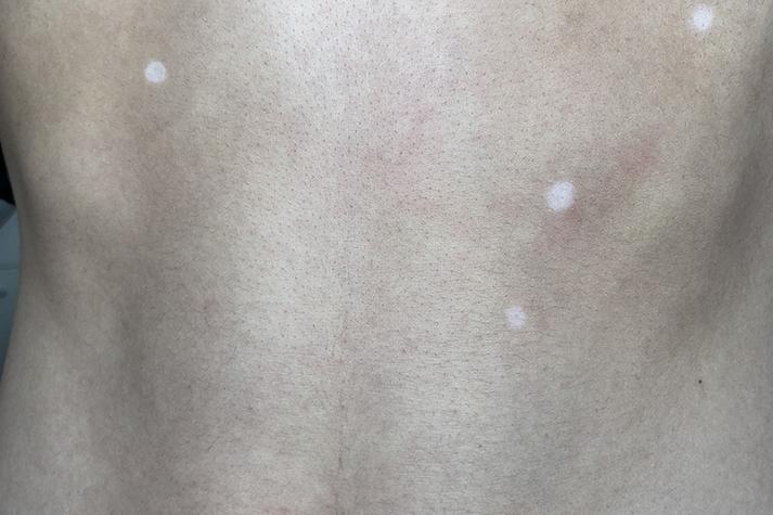 ������ʲô��ҩϴ��