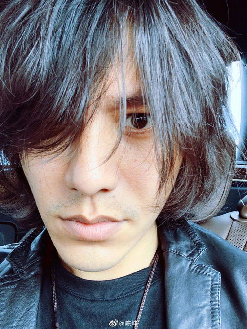 白癜风的症状是什么 南京哪家治疗白癜风的医院好 白癜风的症状是什么 南京哪家治疗白癜风的医院好