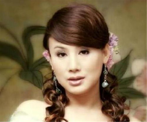 ���粿λ�м����׷�