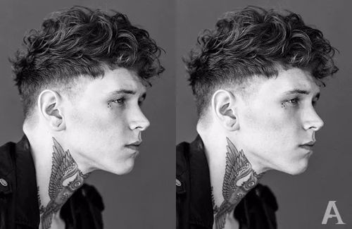 邯郸专治白癜风的正规医院 白癜风进展期与稳定期如何区分 邯郸专治白癜风的正规医院 白癜风进展期与稳定期如何区分