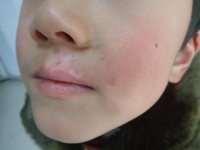 欧莱雅粉饼_欧莱雅粉饼和气垫哪个好用 欧莱雅粉饼_欧莱雅粉饼和气垫哪个好用